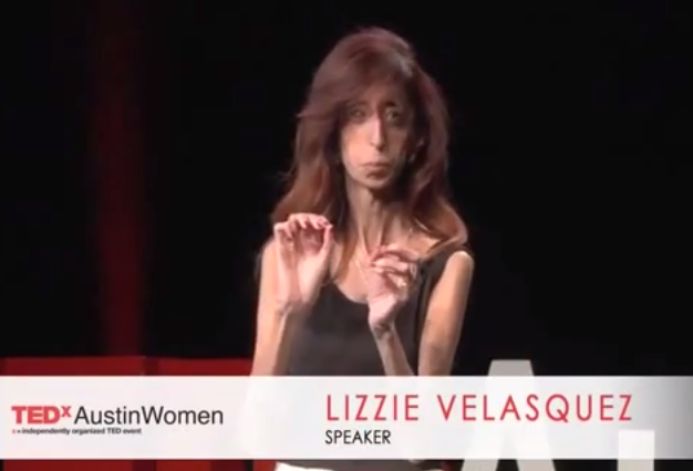 Lizzie Velasquez: «Los obstáculos son peldaños hacia el éxito»